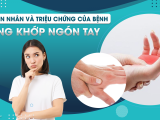 Sưng Khớp Ngón Tay: Nguyên Nhân Và Triệu Chứng Của Bệnh