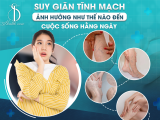 SUY GIÃN TĨNH MẠCH ẢNH HƯỞNG NHƯ THẾ NÀO ĐẾN CUỘC SỐNG HẰNG NGÀY