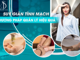 SUY GIÃN TĨNH MẠCH - PHƯƠNG PHÁP QUẢN LÝ HIỆU QUẢ