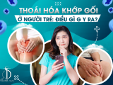 THOÁI HÓA KHỚP GỐI Ở NGƯỜI TRẺ: ĐIỀU GÌ GÂY RA?