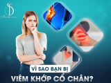 Vì Sao Bạn Bị Viêm Khớp Cổ Chân?