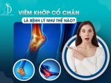Viêm Khớp Cổ Chân Là Bệnh Lý Như Thế Nào?