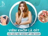 Viêm Khớp Là Gì? Các Dấu Hiệu Nhận Biết Viêm Khớp