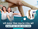 Vớ Giãn Tĩnh Mạch Của Mỹ: Bí Quyết Duy Trì Sức Khỏe Chân