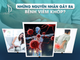 Những Nguyên Nhân Gây Ra Bệnh Viêm Khớp?