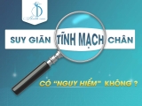 GIÃN TĨNH MẠCH CHÂN CÓ NGUY HIỂM HAY KHÔNG?