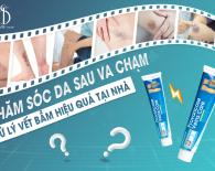 CHĂM SÓC DA SAU VA CHẠM - XỬ LÝ VẾT BẦM HIỆU QUẢ TẠI NHÀ 