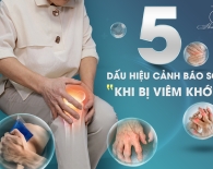 5 Dấu hiệu cảnh báo sớm khi bị viêm khớp